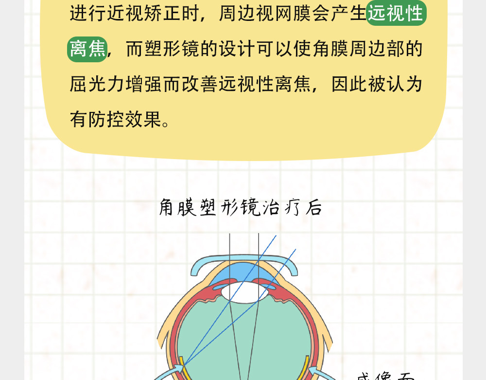 漫话隐形眼镜 戴框架眼镜的烦恼（下） 第33页