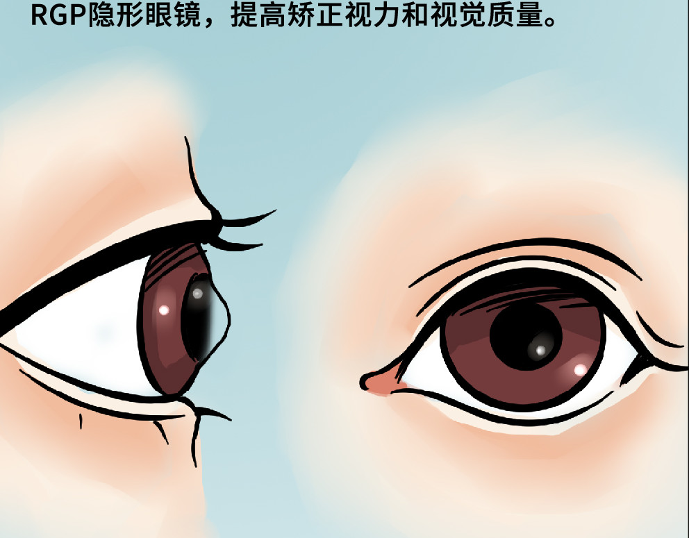 漫话隐形眼镜 一般眼镜店配不了的隐形眼镜 第54页